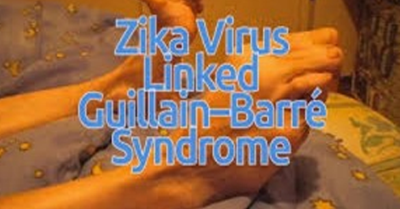 Government Denies Zika Responsible For Latest Guillain Barre Syndrome Cases Local News Tv6tnt Com
