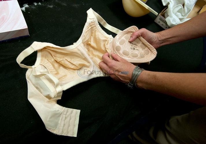 Woman who has had a mastectomy wearing a prosthesis and bra - Stock Image -  C047/0698 - Science Photo Library