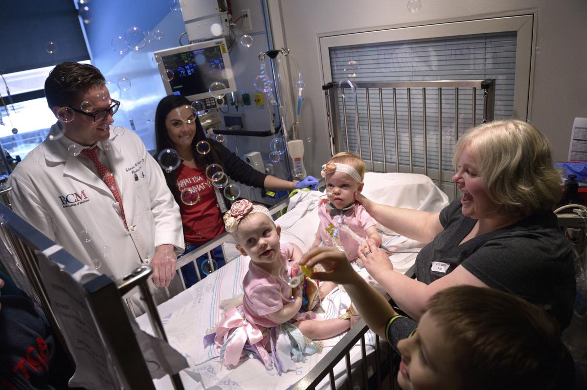Conjoined Twins Separated At Houston Hospital Discharged Health Tylerpaper Com
