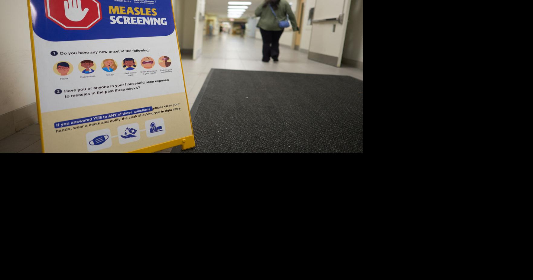 Commentary: Canada lost its measles elimination fight. The US could be next