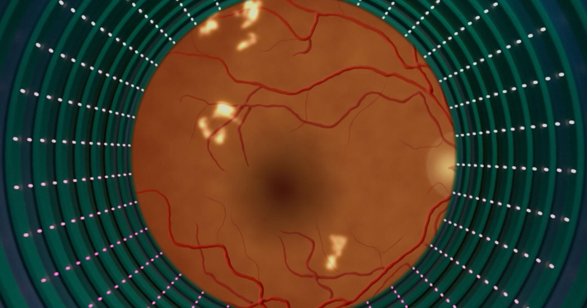As AI eye exams prove their worth, lessons for future tech emerge - Vimarsana News