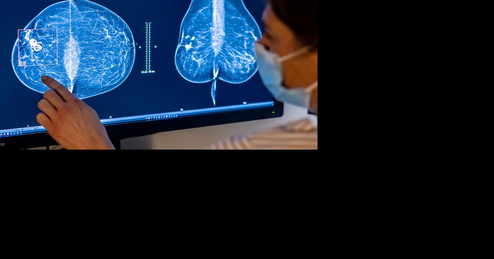Married people less likely to get cancer than singles, doctors find ...