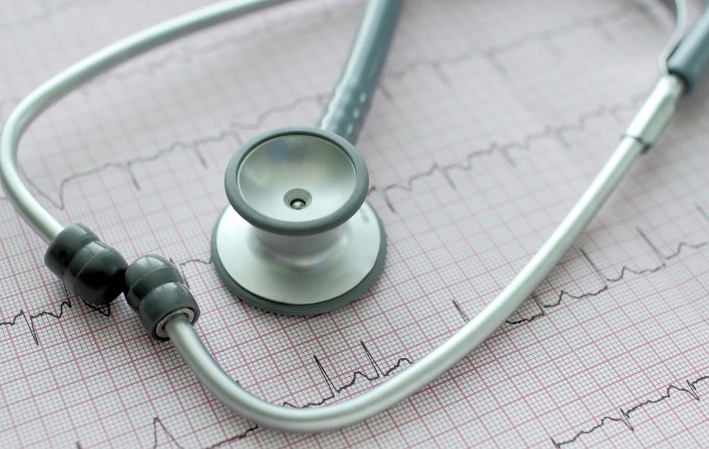 Mayo Clinic Q&A: Is my racing heart an arrhythmia? | Health ...