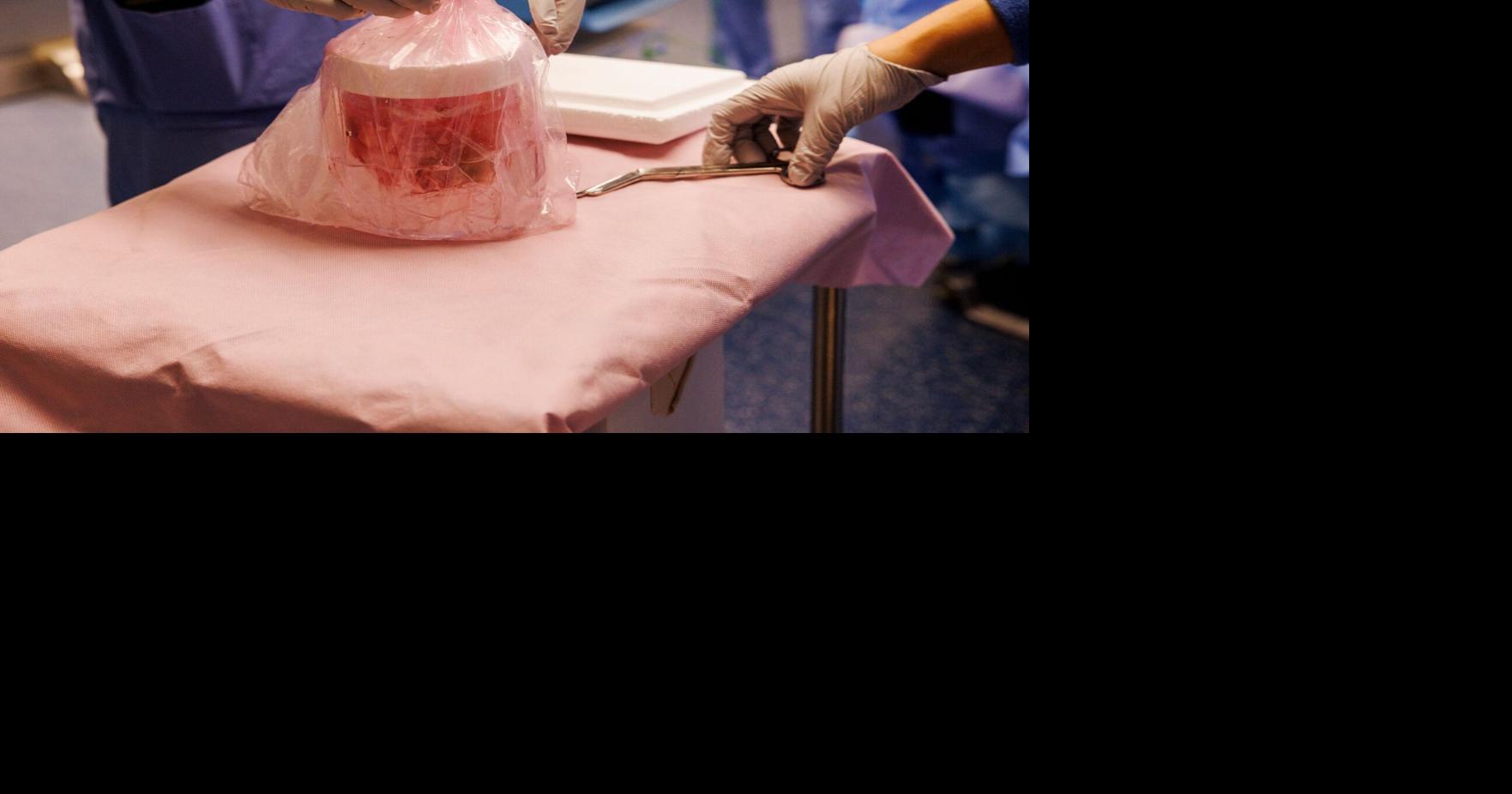 NH man given genetically modified pig kidney for 9 months in world first