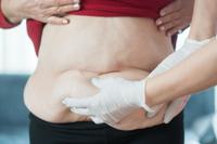 skin removal after glp-1 in jacksonville GoBeyond Aesthetics & Wellness Weight Loss Injections Jacksonville |