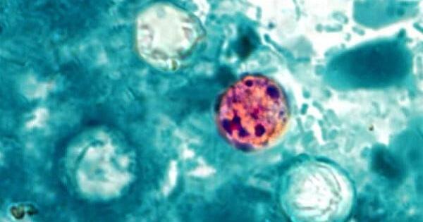New Hampshire cyclosporiasis cases climb to 69 as US outbreak grows