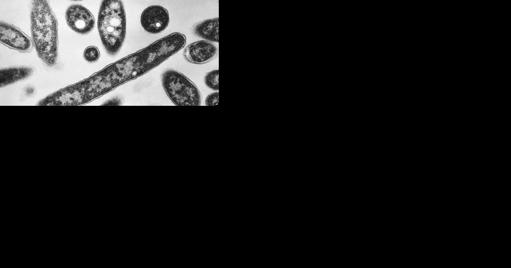 DHHS 'believes' NH resort hot tub may have been source for Legionella exposure that left 1 dead - Vimarsana News