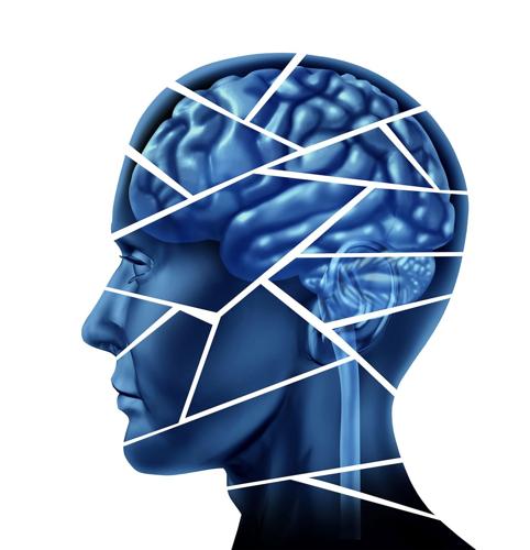 Mild brain injuries tied to increased dementia risk