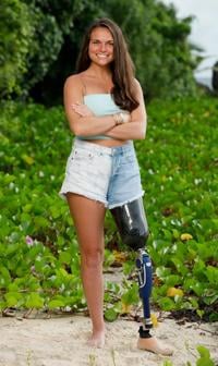 Amputee on the Move: Maria Makes Great Strides With Her New Prosthetic Leg!  