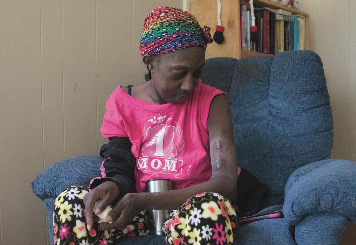Kidney Patients Have At Home Dialysis Option Health