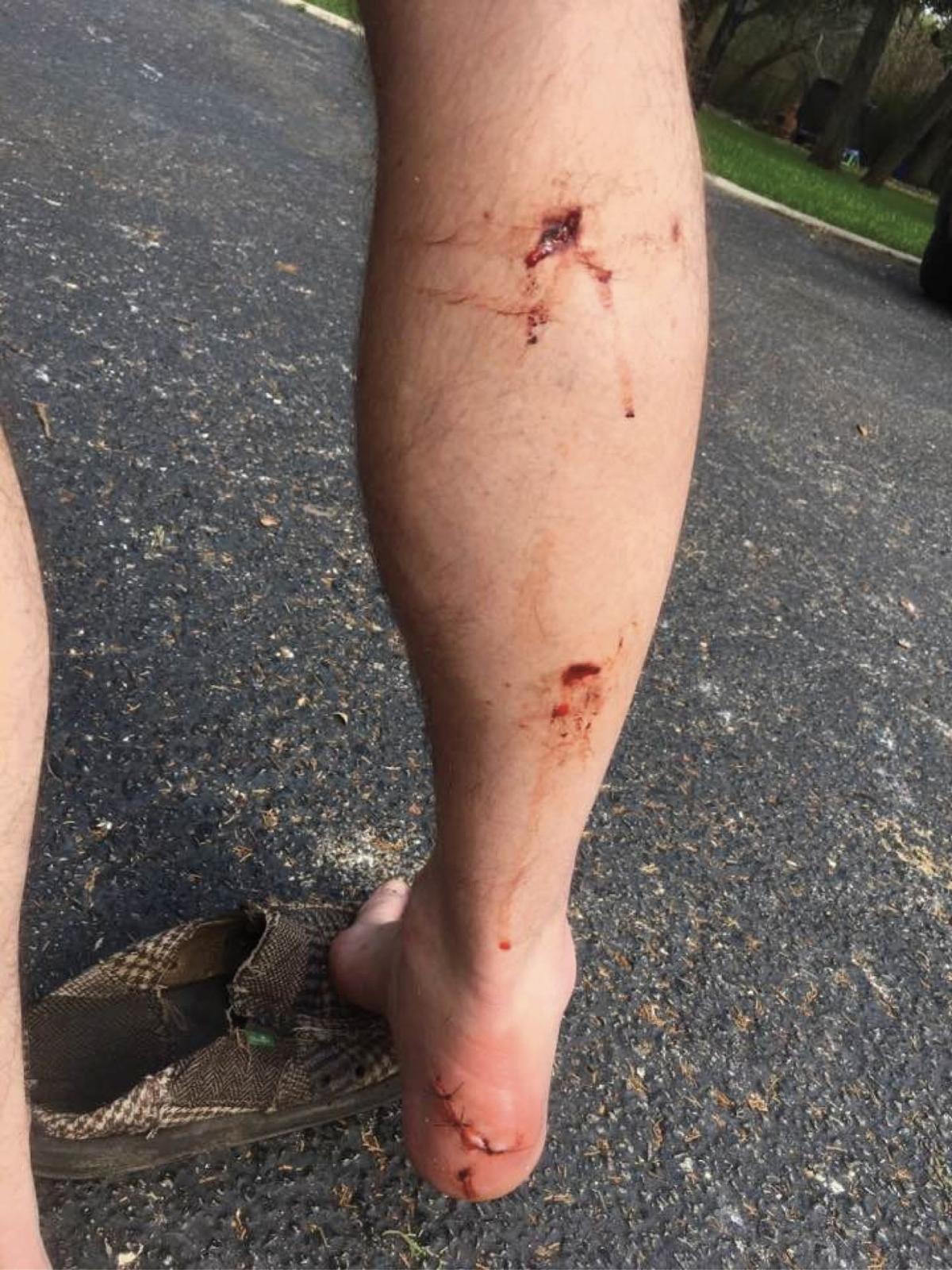 Gator bites man fishing near Port O'Connor | Calhoun | victoriaadvocate.com