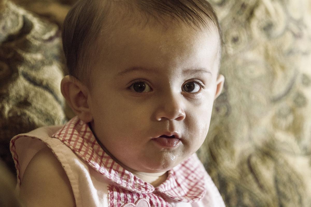 Baby Needs 1 800 Helmet To Shape Skull Business Victoriaadvocate Com