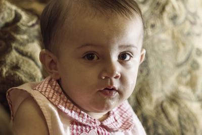 Baby Needs 1 800 Helmet To Shape Skull Business Victoriaadvocate Com