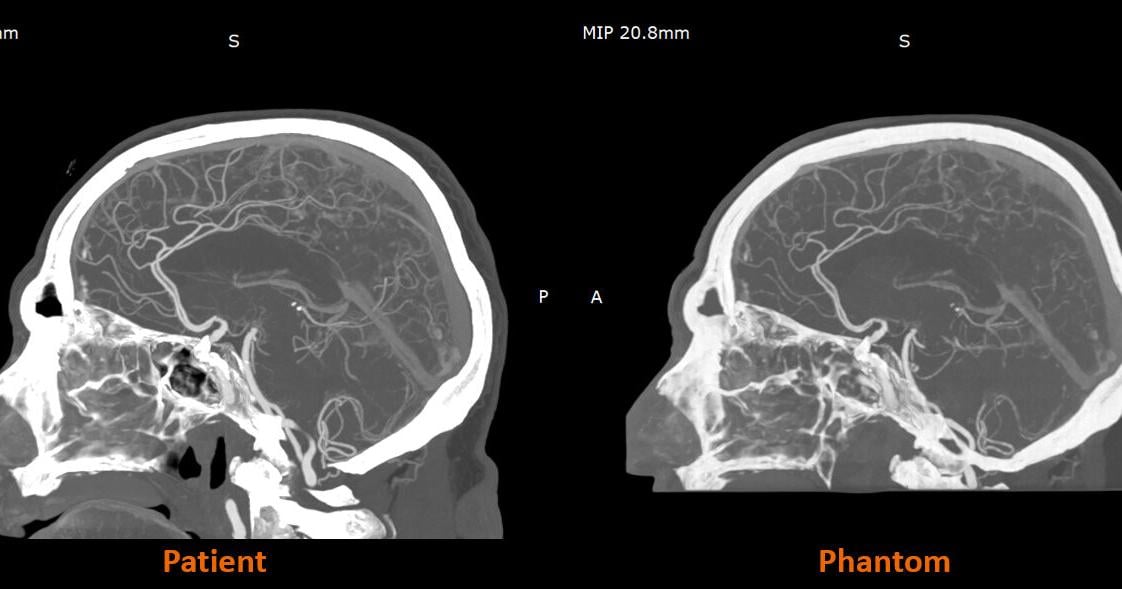 Stratasys Expands Availability of RadioMatrix™ Radiopaque Material to the United States
