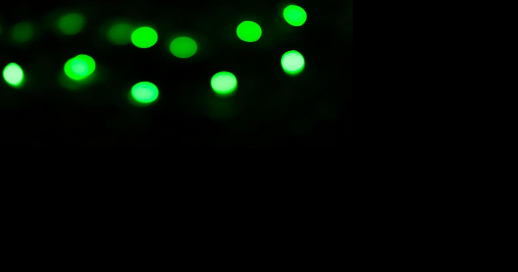 Japanese scientists’ ‘living skin’ implant glows to warn of illness