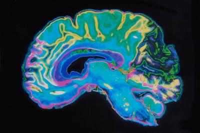 A detailed look at children’s brains might show how sex and gender are different, new study says