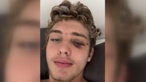 Tuscumbia police send Deshler football player August Borden's injury