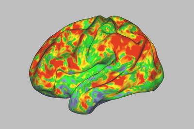 This is your brain on psilocybin