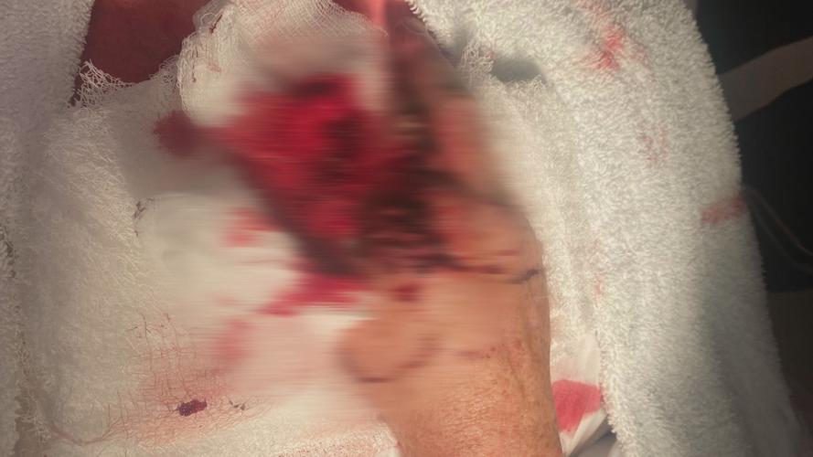 Sgt. Wittmer's Hand (Blurred).jpg