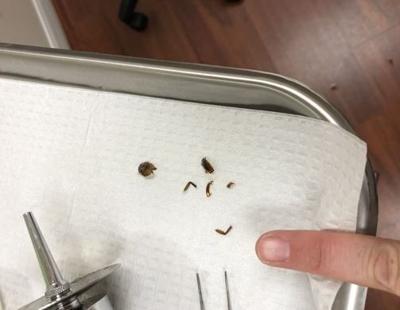 NOPE! Florida woman finds cockroach in her ear