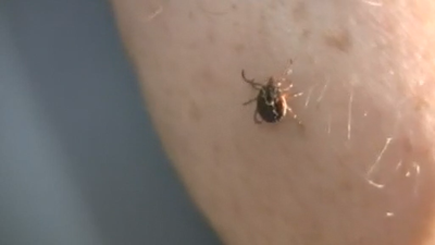 Lyme Disease