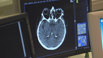 A Majority of Americans Unaware Concussions Affect Women More than Men