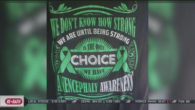 Anencephaly Awareness Month