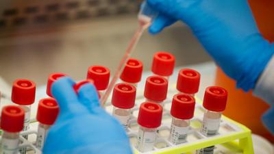 Coronavirus testing
