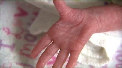 NICU baby