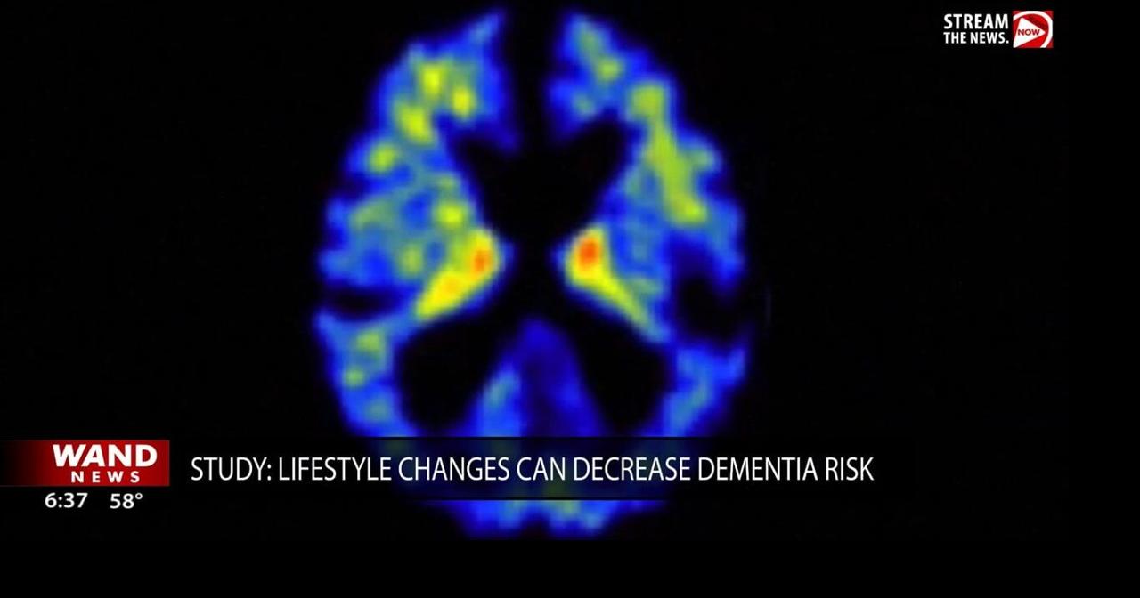 Lifestyle changes could impact dementia risk, study shows