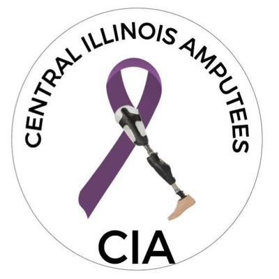 Woman using amputation to help fellow amputees