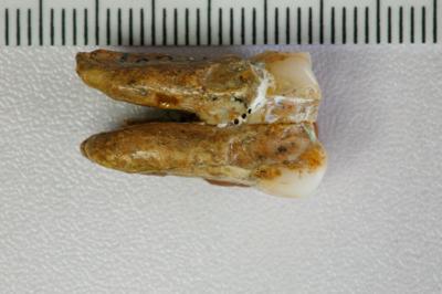 Ancient Human Teeth