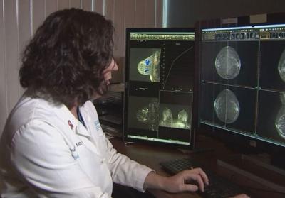 Free mammogram screenings offered in Illinois