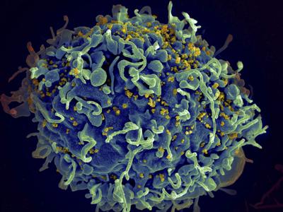 Global AIDS Report