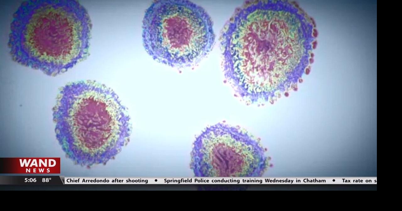 Covid19 cases increase in Champaign Top Stories