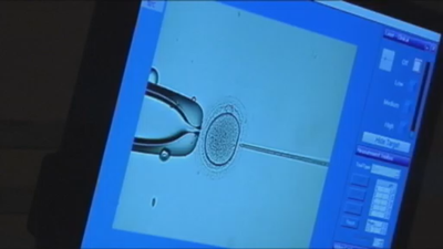 IVF