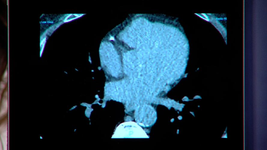 Heart scans