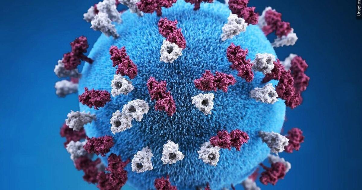 Measles cases spike from 2 to 15 in southwestern Wisconsin