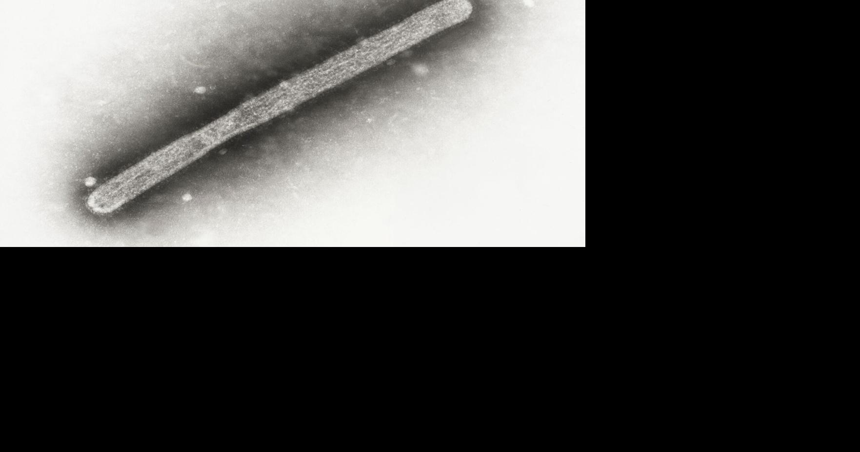 Barron County poultry flock quarantined after highly pathogenic bird ...
