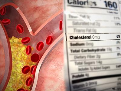 Cholesterol MGN