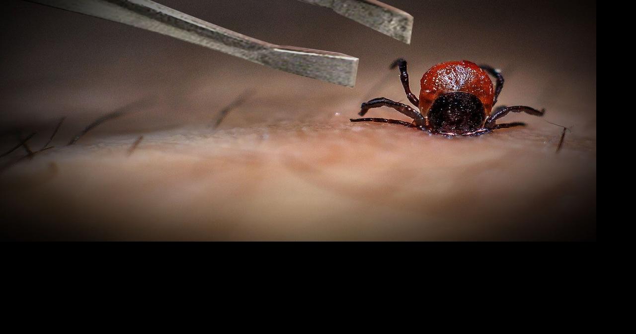 More ticks, risk of Lyme disease in Wisconsin News