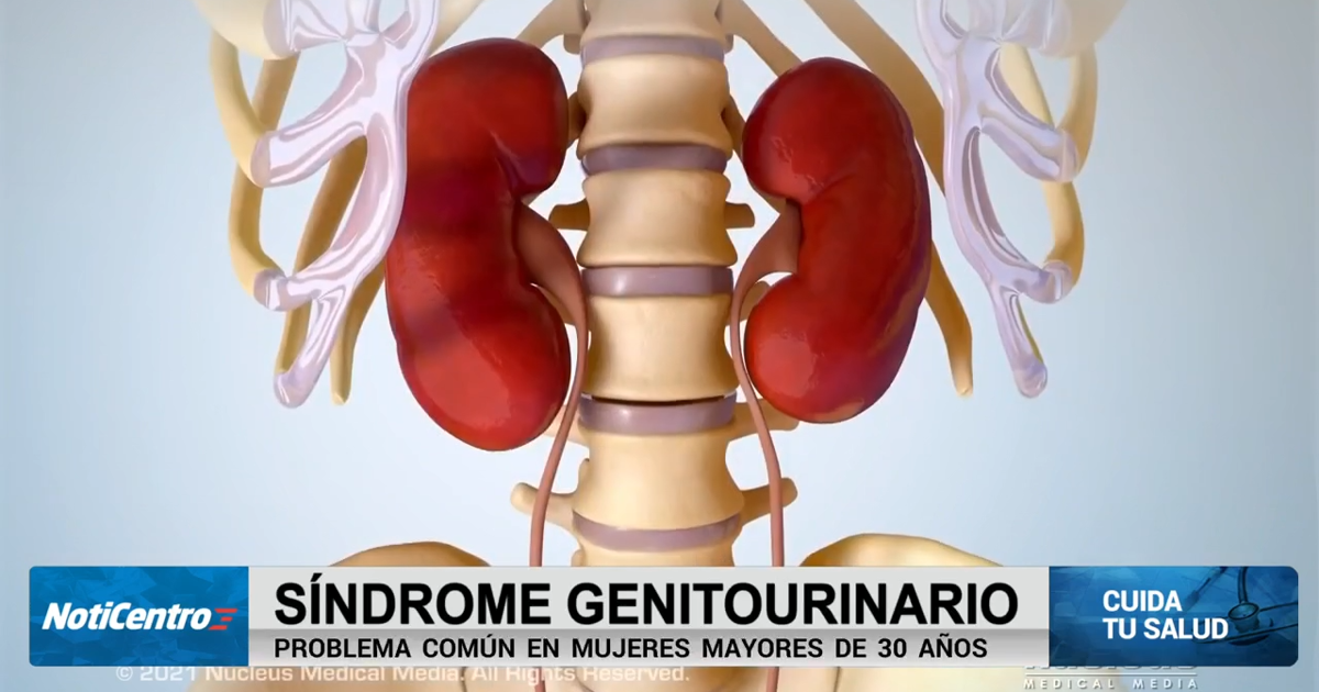 Cuida tu salud: síndrome genitourinario en incontinencia