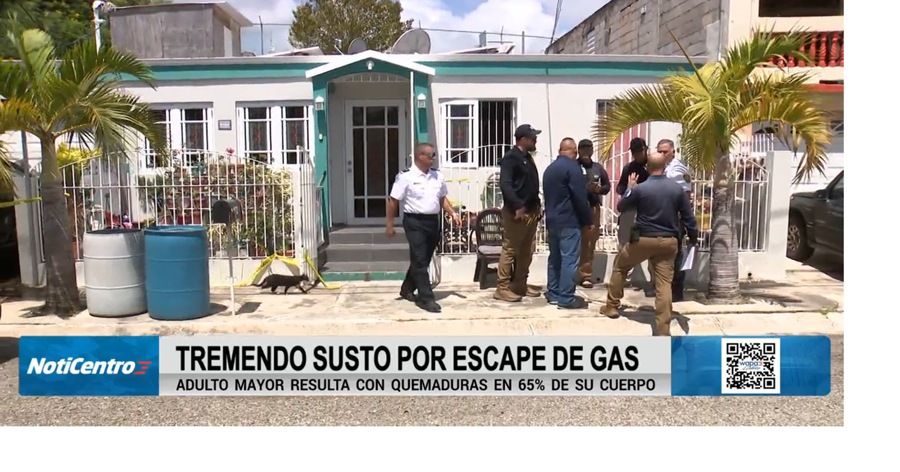 "La prendió para hacer café": Esposa de hombre que sufrió quemaduras narra momento de quema de gas