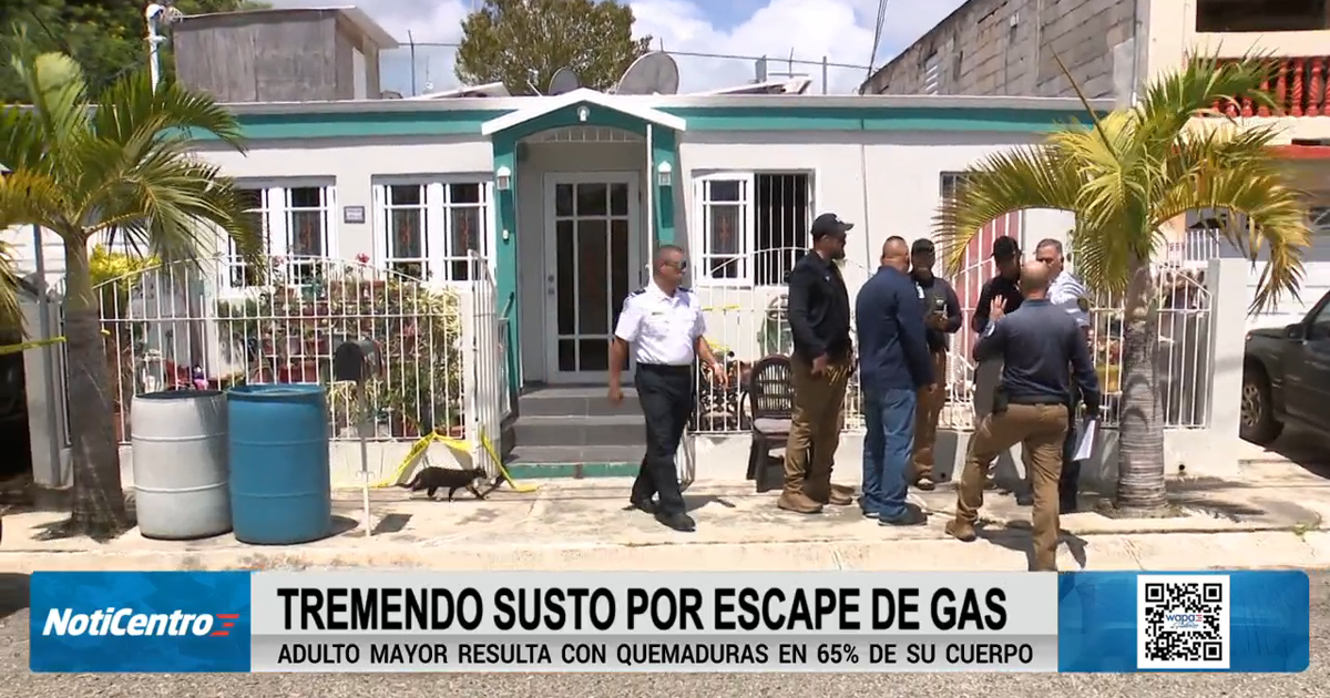 "La prendió para hacer café": Esposa de hombre que sufrió quemaduras narra momento de quema de gas