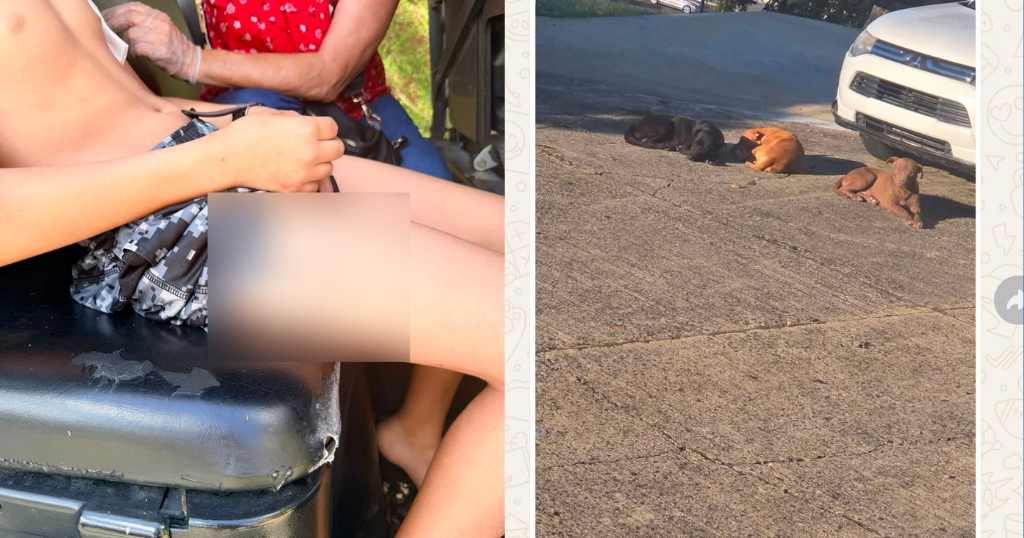 Niño atleta de 11 años atacado por perros realengos en pabellón deportivo de San Sebastián
