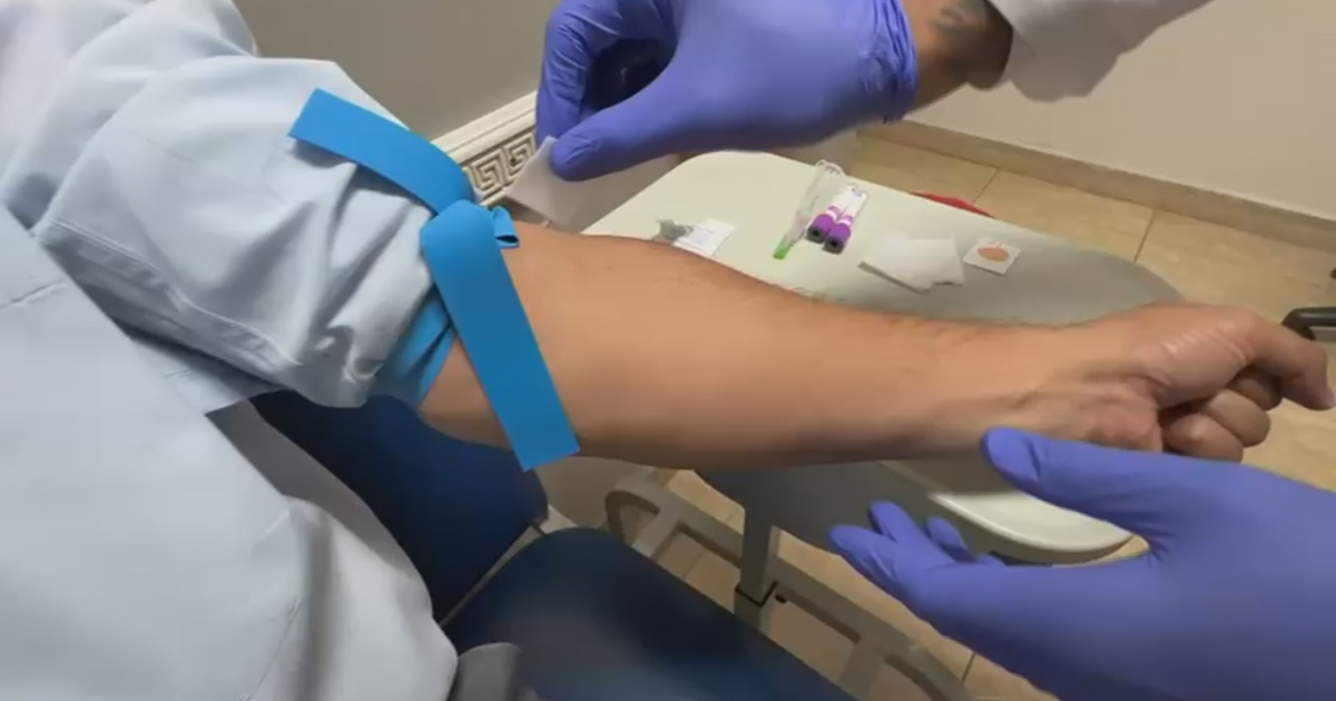 Nueva prueba de sangre ayuda a diagnosticar Alzheimer