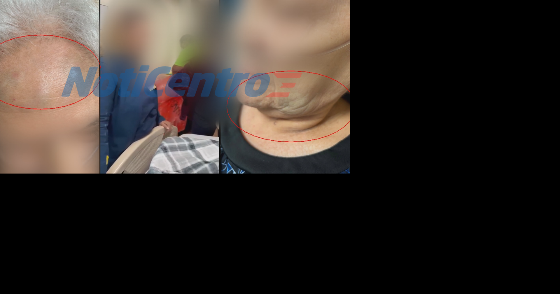 Hija denuncia que enfermeros golpearon a su madre de 83 años en hospital de Río Piedras
