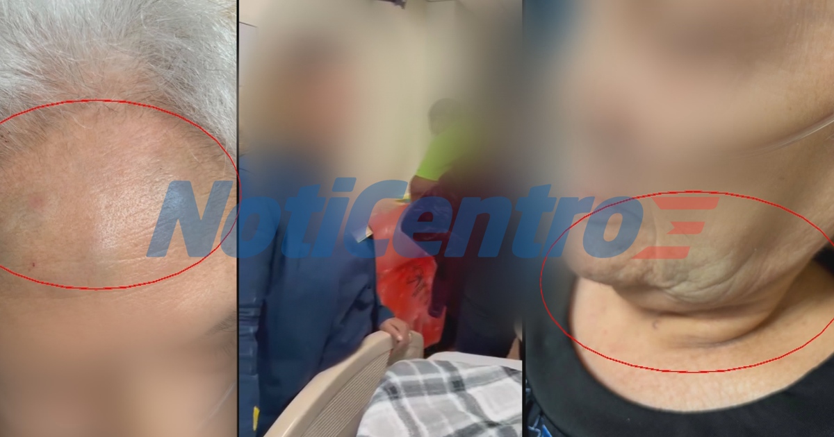 Hija denuncia que enfermeros golpearon a su madre de 83 años en hospital de Río Piedras