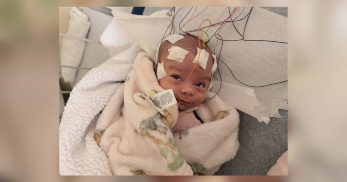 Bebé de ocho meses es diagnosticada con rara condición genética