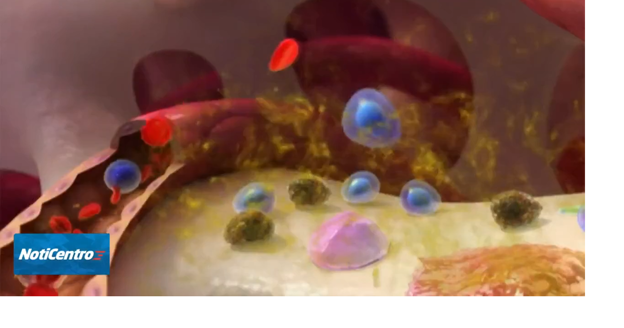 Car-T, nuevo tratamiento con células modificadas genéticamente para el mieloma múltiple